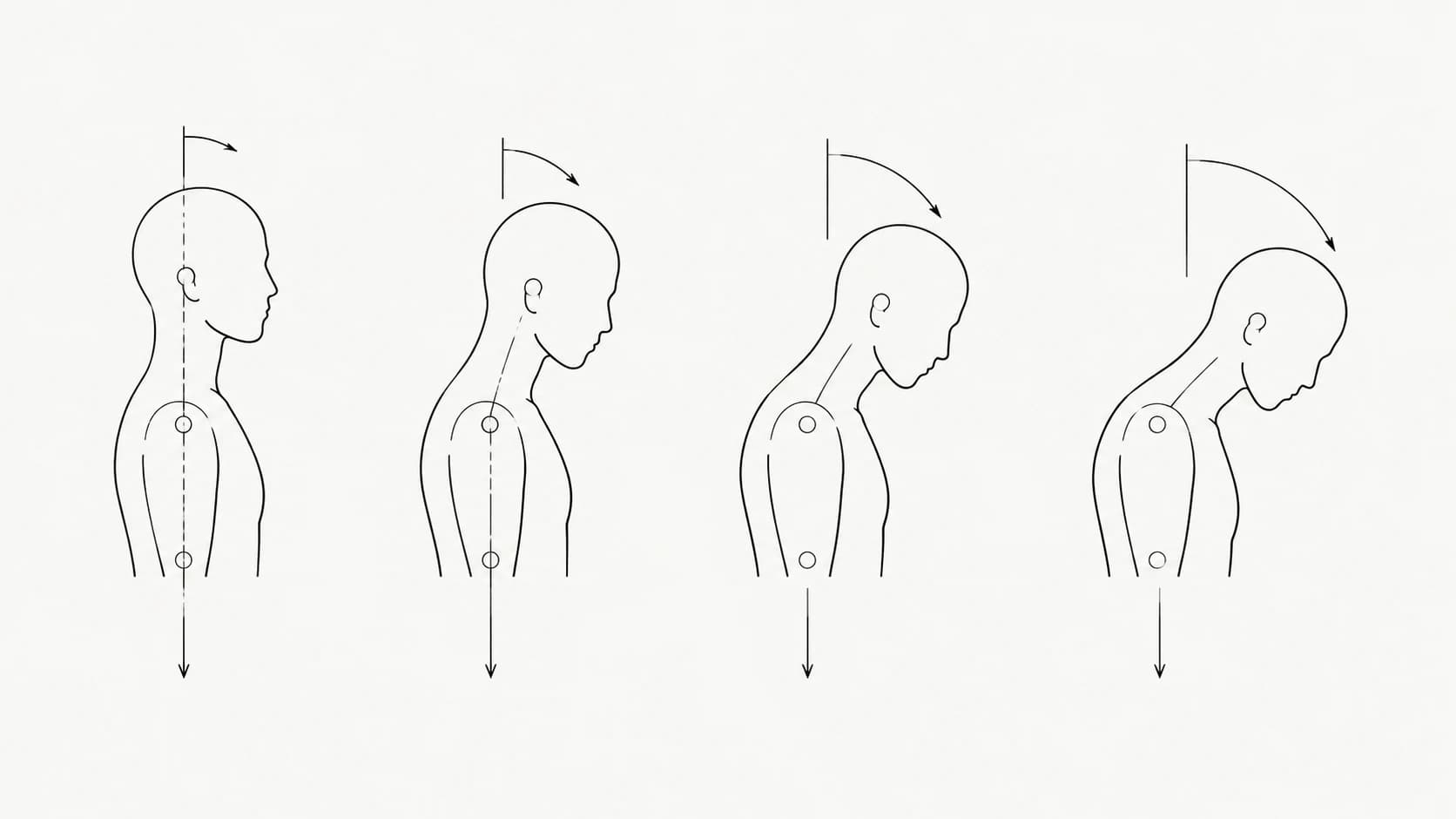 A side-view line diagram of a head and neck at four increasing forward angles, each marked with an arc and a load arrow